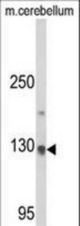 Western blot of CLIP1 Antibody in mouse cerebellum tissue lysates (35 ug/lane). CLIP1 (arrow) was detected using the purified antibody.