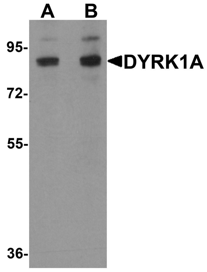 Western blot analysis of DYRK1A in HeLa cell lysate with DYRK1A antibody at (A) 1 and (B) 2 ug/ml.