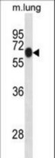 Mouse Dyrk1b Antibody western blot of mouse lung tissue lysates (35 ug/lane). The Dyrk1b antibody detected the Dyrk1b protein (arrow).