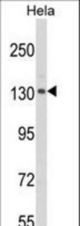 Western blot of CLIP1 Antibody in HeLa cell line lysates (35 ug/lane). CLIP1 (arrow) was detected using the purified antibody.