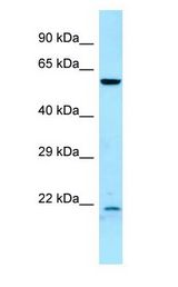 DYRK2 antibody Western Blot of Fetal Lung.