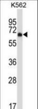 Mouse Dyrk2 Antibody western blot of K562 cell line lysates (35 ug/lane). The Dyrk2 antibody detected the Dyrk2 protein (arrow).