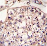 DYRK2 Antibody immunohistochemistry of formalin-fixed and paraffin-embedded human testis tissue followed by peroxidase-conjugated secondary antibody and DAB staining.