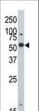 The anti-DYRK2 antibody is used in Western blot to detect DYRK2 in 293 cell lysate.
