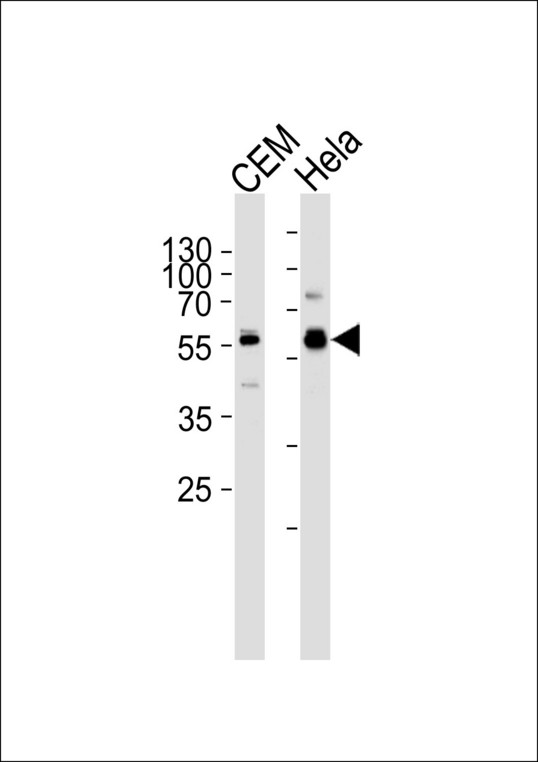 Western blot of lysates from CEM, HeLa cell line (from left to right), using DYRK2 Antibody (P46). Antibody was diluted at 1:1000 at each lane. A goat anti-rabbit IgG H&L (HRP) at 1:5000 dilution was used as the secondary antibody. Lysates at 35ug per lane.