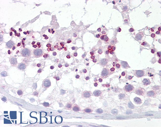 Anti-DYRK2 antibody IHC of human testis. Immunohistochemistry of formalin-fixed, paraffin-embedded tissue after heat-induced antigen retrieval. Antibody LS-B7095 concentration 5 ug/ml.