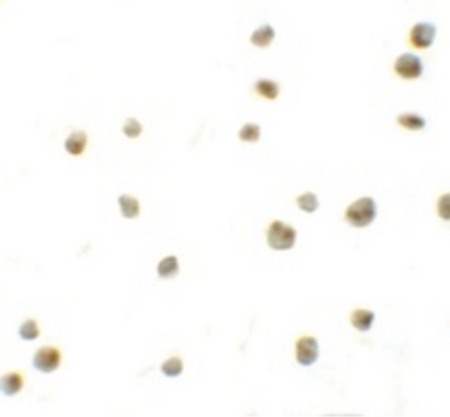 Immunocytochemistry of DYRK2 in 293 cells with DYRK2 antibody at 10 ug/ml.