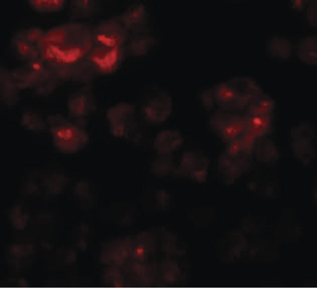 Immunofluorescence of DYRK2 in 293 cells with DYRK2 antibody at 20 ug/ml.
