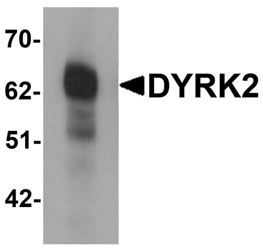 Western blot analysis of DYRK2 in 293 cell lysate with DYRK2 antibody at (A) 1 and (B) 2 ug/ml.