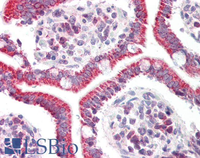 Anti-DYRK2 antibody IHC staining of human small intestine. Immunohistochemistry of formalin-fixed, paraffin-embedded tissue after heat-induced antigen retrieval. Antibody LS-B11488 concentration 10 ug/ml.