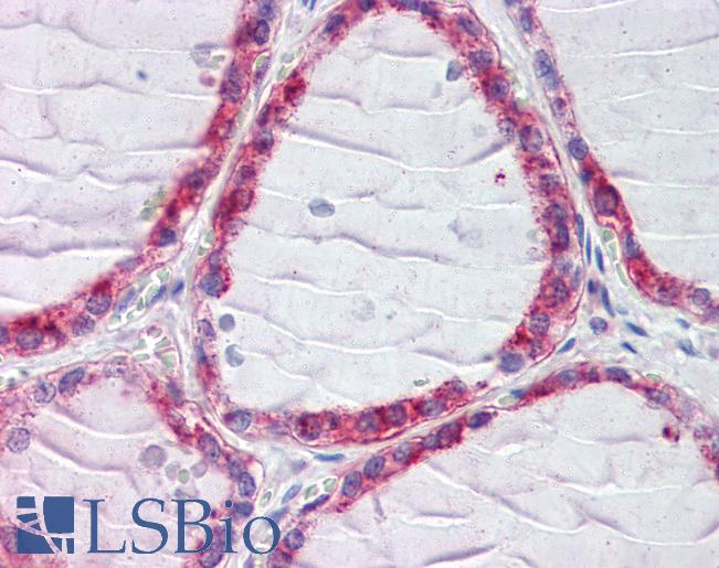 Anti-CLIP1 / CLIP170 antibody IHC of human thyroid. Immunohistochemistry of formalin-fixed, paraffin-embedded tissue after heat-induced antigen retrieval. Antibody LS-B3615 concentration 2.5 ug/ml.