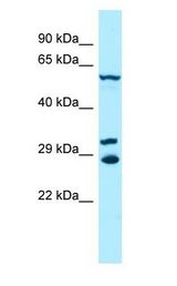 DYRK2 antibody Western Blot of Jurkat.