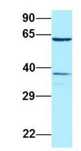 DYRK2 antibody Western Blot of Human Placenta. Antibody Dilution: 1.0ug/ml. Antibody dilution: 1 ug/ml.