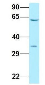 DYRK2 antibody Western Blot of Human Fetal Lung. Antibody Dilution: 1.0 ug/ml. Antibody dilution: 1 ug/ml.
