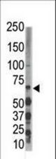 Western blot of anti-DYRK3 antibody in Jurkat cell lysate. DYRK3 (arrow) was detected using purified antibody. Secondary HRP-anti-rabbit was used for signal visualization with chemiluminescence.