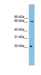 DYRK3 antibody LS-C115959 Western blot of THP-1 cell lysate.