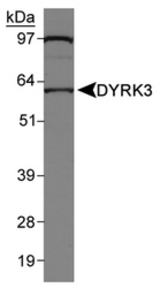 Detection of DYRK3 in Jurkat nuclear extracts.