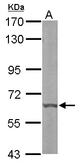 Sample (50 ug of whole cell lysate). A: mouse liver. 7.5% SDS PAGE. DYRK3 antibody diluted at 1:1000.