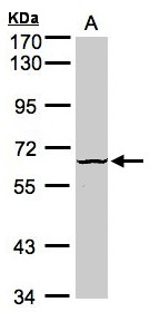 Sample (30g whole cell lysate). A: Raji . 7.5% SDS PAGE. DYRK3 antibody diluted at 1:1000