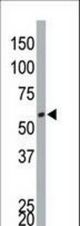 The anti-DYRK4 antibody is used in Western blot to detect DYRK4 in Jurkat cell lysate.