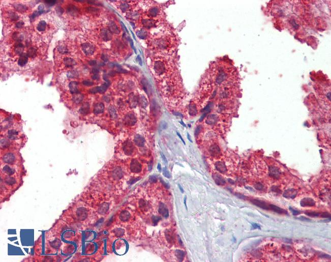 Anti-CLIP1 / CLIP170 antibody IHC of human prostate. Immunohistochemistry of formalin-fixed, paraffin-embedded tissue after heat-induced antigen retrieval. Antibody LS-B3615 concentration 2.5 ug/ml.