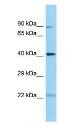 CHID1 antibody Western Blot of Placenta.