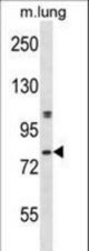 Mouse Dyrk4 Antibody western blot of mouse lung tissue lysates (35 ug/lane). The Dyrk4 antibody detected the Dyrk4 protein (arrow).
