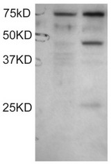 Antibody staining (0.1 ug/ml) of COS1 cell lysates: untransfected (left lane) and transfected with full length recombinant Human DYX1C1 (right lane). Data kindly provided by Wang and LoTurco, University of Connecticut, USA.