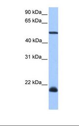Hela cell lysate. Antibody concentration: 1.0 ug/ml. Gel concentration: 12%.