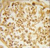 Formalin-fixed and paraffin-embedded human testis tissue reacted with DZIP1 Antibody , which was peroxidase-conjugated to the secondary antibody, followed by DAB staining. This data demonstrates the use of this antibody for immunohistochemistry; clinical relevance has not been evaluated.
