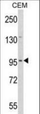 Western blot of DZIP1 Antibody in CEM cell line lysates (35 ug/lane). DZIP1 (arrow) was detected using the purified antibody.