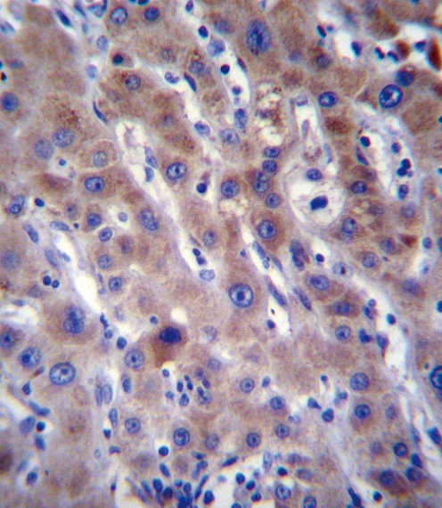 FADS2 Antibody immunohistochemistry of formalin-fixed and paraffin-embedded human liver tissue followed by peroxidase-conjugated secondary antibody and DAB staining.