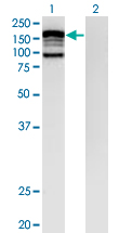 Western Blot analysis of CLIP2 expression in transfected 293T cell line by CLIP2 monoclonal antibody (M07), clone 3H5.Lane 1: CLIP2 transfected lysate (Predicted MW: 115.06 KDa).Lane 2: Non-transfected lysate.