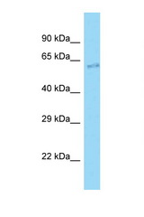 CLIP3 antibody LS-C146352 Western blot of Mouse Liver lysate. Antibody concentration 1 ug/ml.