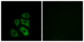 Immunofluorescence of A549 cells, using CLIP3 Antibody. The picture on the right is treated with the synthesized peptide.
