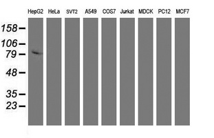 Western blot of extracts (35ug) from 9 different cell lines by using anti-DPP3 monoclonal antibody.