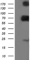 HEK293T cells were transfected with the pCMV6-ENTRY control (Left lane) or pCMV6-ENTRY DPP3 (Right lane) cDNA for 48 hrs and lysed. Equivalent amounts of cell lysates (5 ug per lane) were separated by SDS-PAGE and immunoblotted with anti-DPP3.