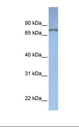 Jurkat cell lysate. Antibody concentration: 1.0 ug/ml. Gel concentration: 12%.