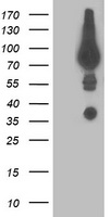 HEK293T cells were transfected with the pCMV6-ENTRY control (Left lane) or pCMV6-ENTRY DPP3 (Right lane) cDNA for 48 hrs and lysed. Equivalent amounts of cell lysates (5 ug per lane) were separated by SDS-PAGE and immunoblotted with anti-DPP3.