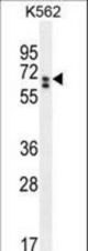 CLIP3 Antibody western blot of K562 cell line lysates (35 ug/lane). The CLIP3 antibody detected the CLIP3 protein (arrow).