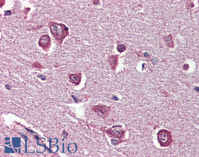 Anti-DPP10 antibody LS-A8300 IHC of human brain, cortex. Immunohistochemistry of formalin-fixed, paraffin-embedded tissue after heat-induced antigen retrieval.