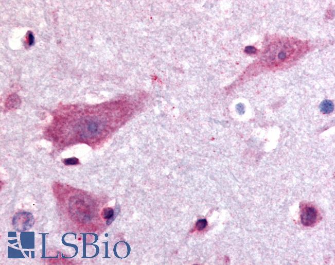 Anti-DPP10 antibody LS-A8304 IHC of human brain, neurons. Immunohistochemistry of formalin-fixed, paraffin-embedded tissue after heat-induced antigen retrieval.