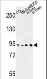 Western blot of DPP10 Antibody in Y79, MDA-MB231 cell line and mouse liver, brain tissue lysates (35 ug/lane). DPP10 (arrow) was detected using the purified antibody.