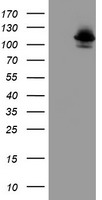HEK293T cells were transfected with the pCMV6-ENTRY control (Left lane) or pCMV6-ENTRY DPP8 (Right lane) cDNA for 48 hrs and lysed. Equivalent amounts of cell lysates (5 ug per lane) were separated by SDS-PAGE and immunoblotted with anti-DPP8.