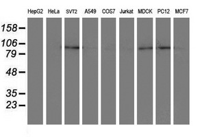 Western blot of extracts (35 ug) from 9 different cell lines by using anti-DPP8 monoclonal antibody.
