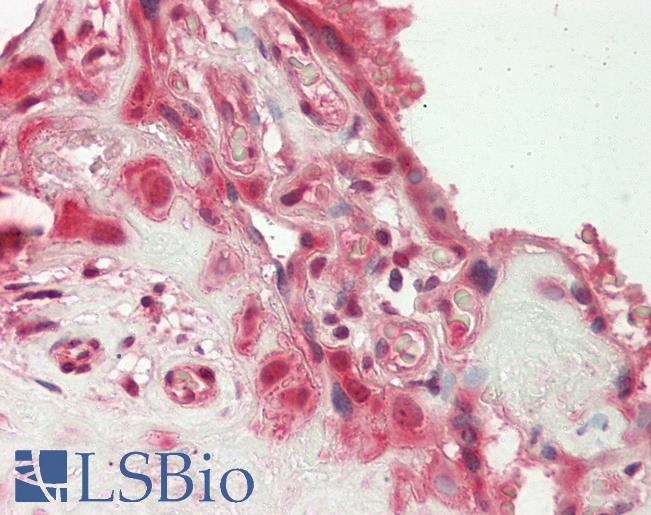 Human Placenta: Formalin-Fixed, Paraffin-Embedded (FFPE)