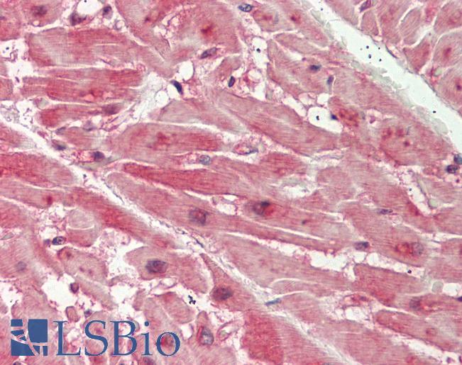 Human Heart: Formalin-Fixed, Paraffin-Embedded (FFPE)