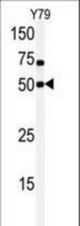 Western blot of anti-hCLK1-C84 antibody in Y79 cell line lysate. hCLK1-C84(arrow) was detected using the purified antibody.