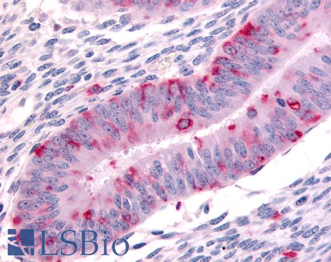 Anti-DPP8 antibody LS-A8035 IHC of human uterus. Immunohistochemistry of formalin-fixed, paraffin-embedded tissue after heat-induced antigen retrieval.