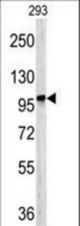 Western blot of DPP8 antibody in 293 cell line lysates (35 ug/lane). DPP8 (arrow) was detected using the purified antibody.